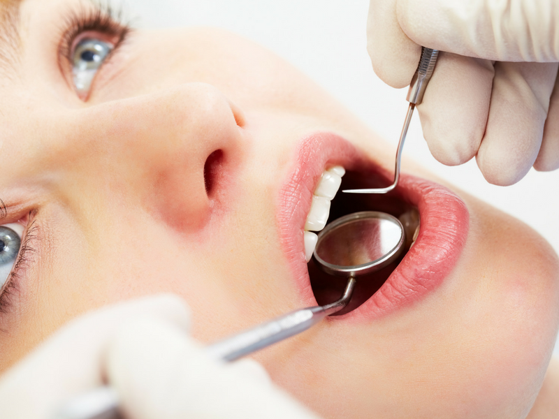 periodontal disease is linked to oral cancer