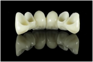 dental_bridges in Silver spring & hyattsville, MD