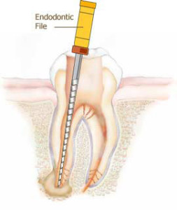 endodontics in silver spring maryland
