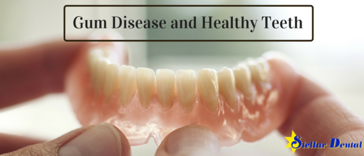 Gum Disease and Healthy Teeth