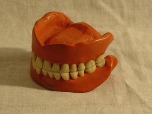 missing teeth