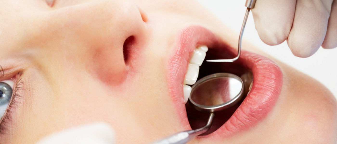 How Periodontal Disease May Raise Your Oral Cancer Risk