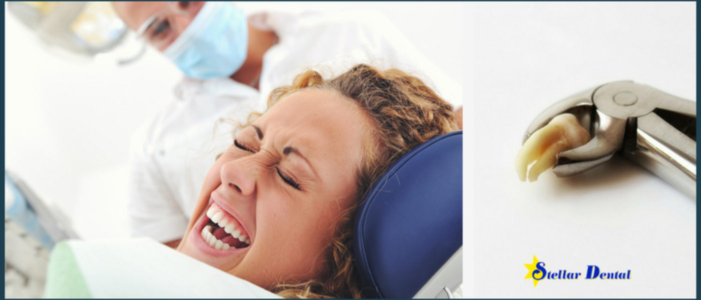 Aftercare Tips for Wisdom Teeth Removal