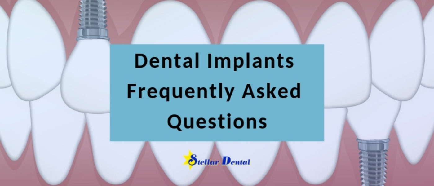 Dental Implants: Get the Answers to Frequently Asked Questions