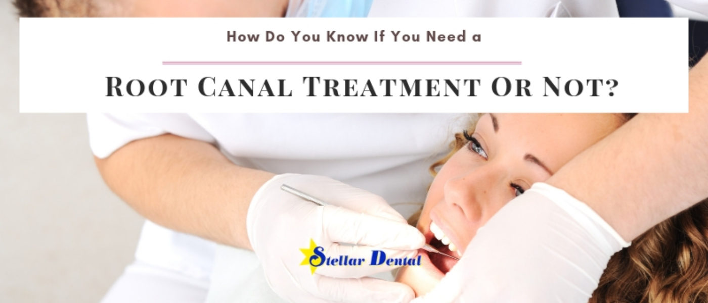 How Do You Know If You Need a Root Canal Treatment Or Not?