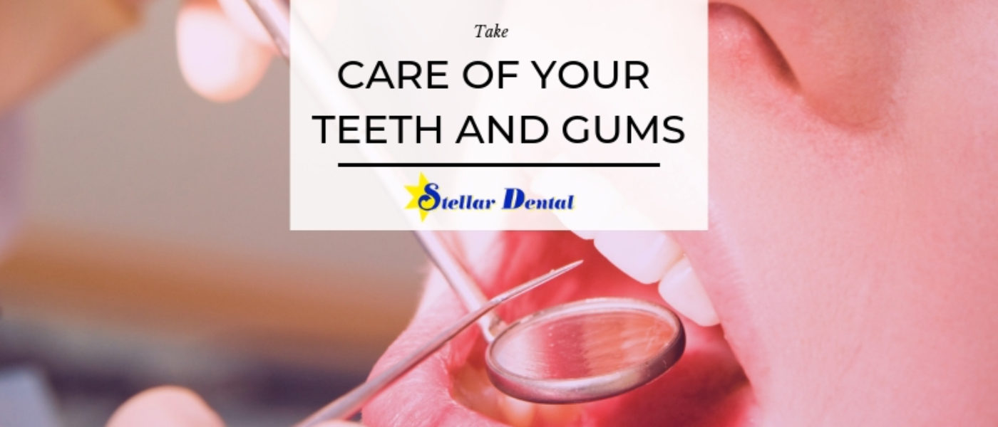 How to Take Care of Your Teeth and Gums